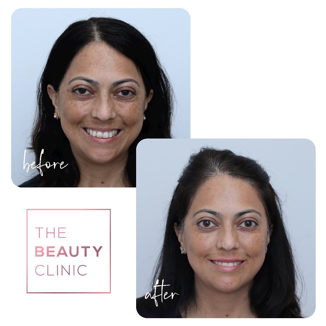 The Beauty Clinic Before and After