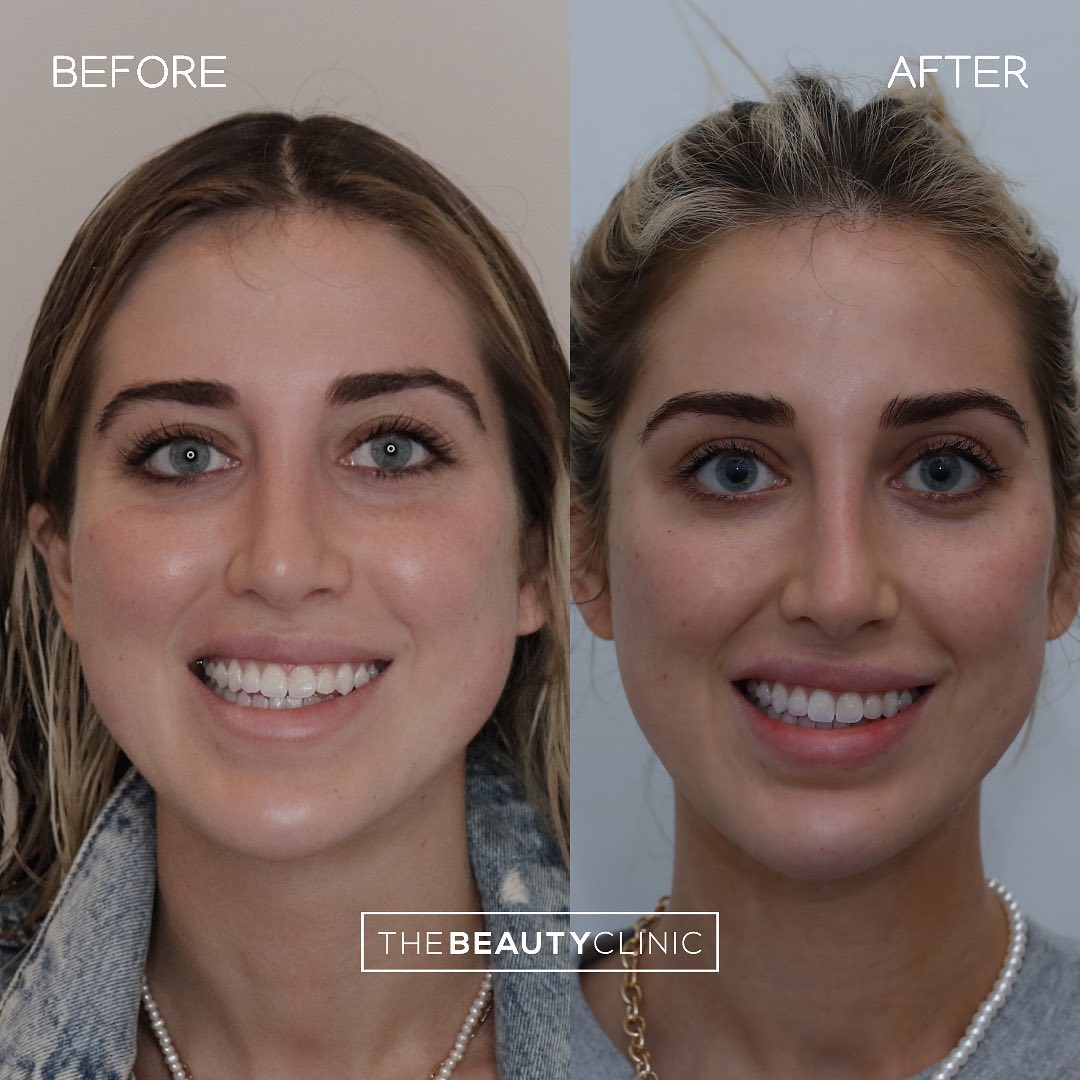 The Beauty Clinic Cosmetic Injections