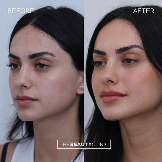 The Beauty Clinic Before and After