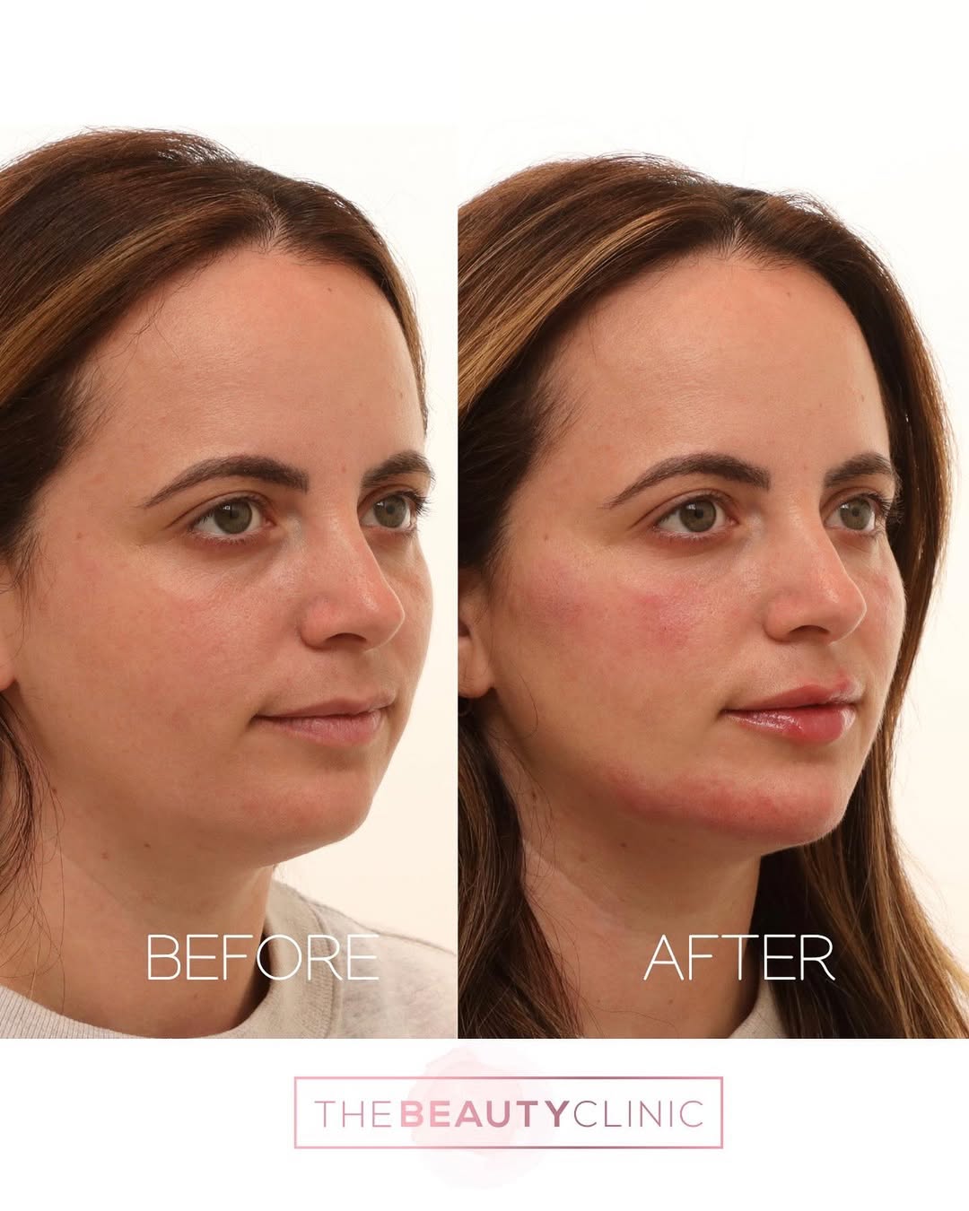 The Beauty Clinic Before and After