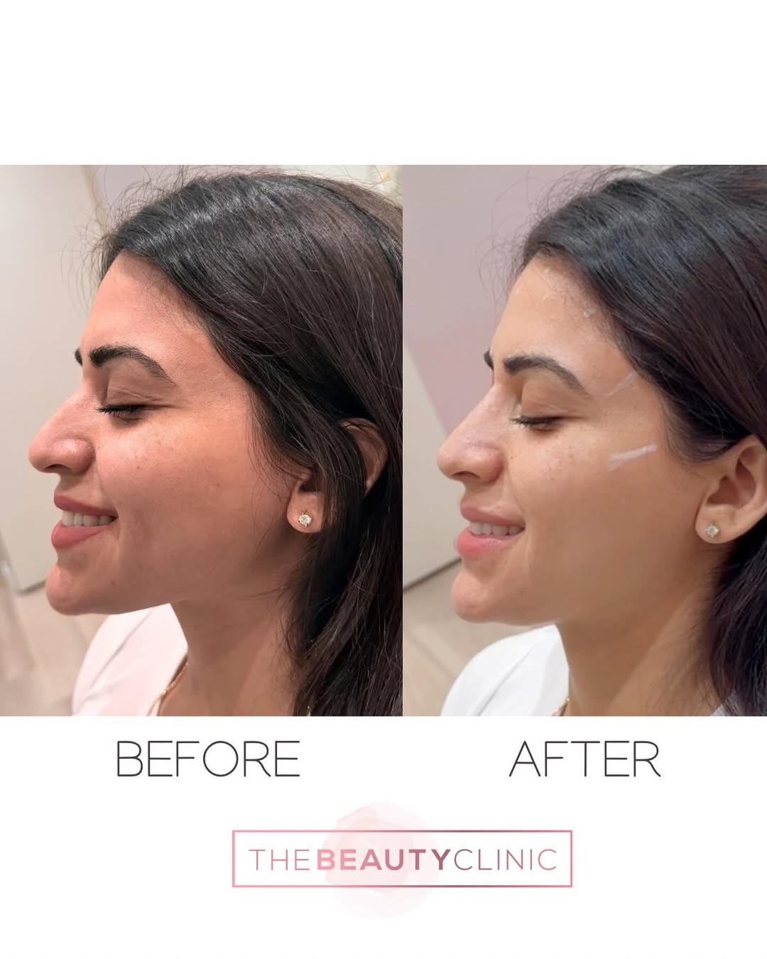 The Beauty Clinic Before and After