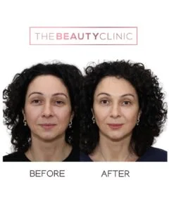 The Beauty Clinic Before and After