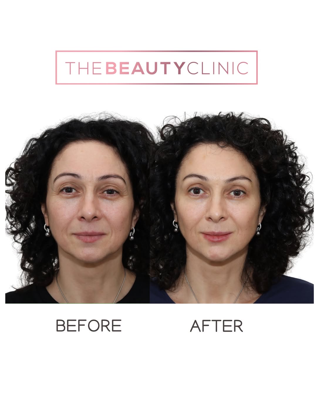 The Beauty Clinic Before and After
