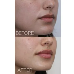 The Beauty Clinic Before and After